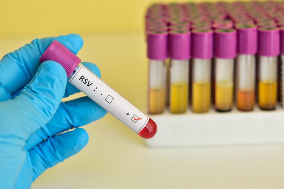 hMPV: alta na circulação de vírus respiratório na China acende alerta