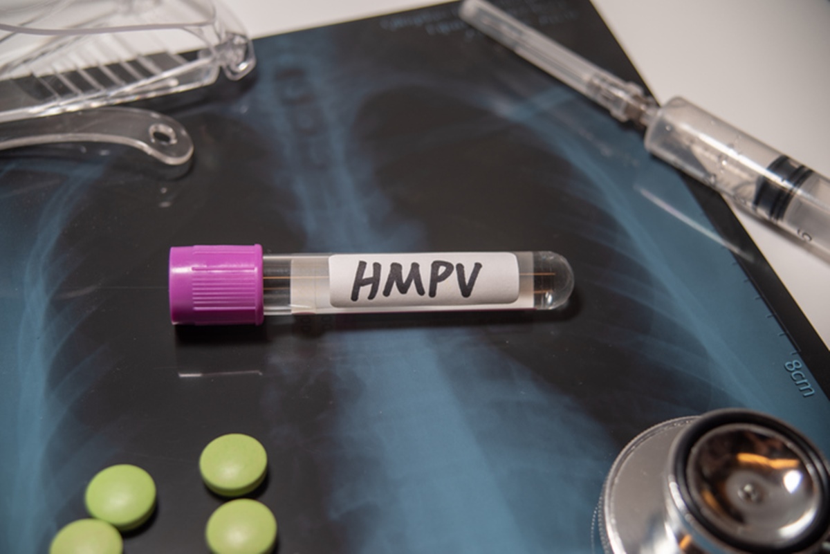 Surto do vírus hMPV na China pode causar nova pandemia? Entenda