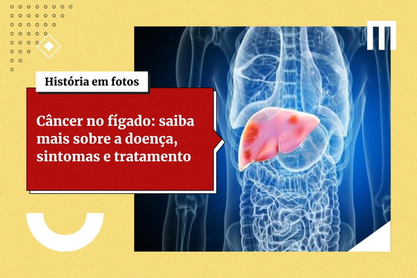 Problemas no fígado? Médico lista 5 alimentos para desintoxicar