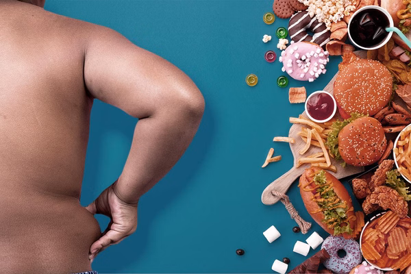 Estudo: 60% dos adultos do mundo terão sobrepeso ou obesidade até 2050