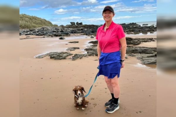 Mulher sente cheiros bizarros e é diagnosticada com câncer no cérebro