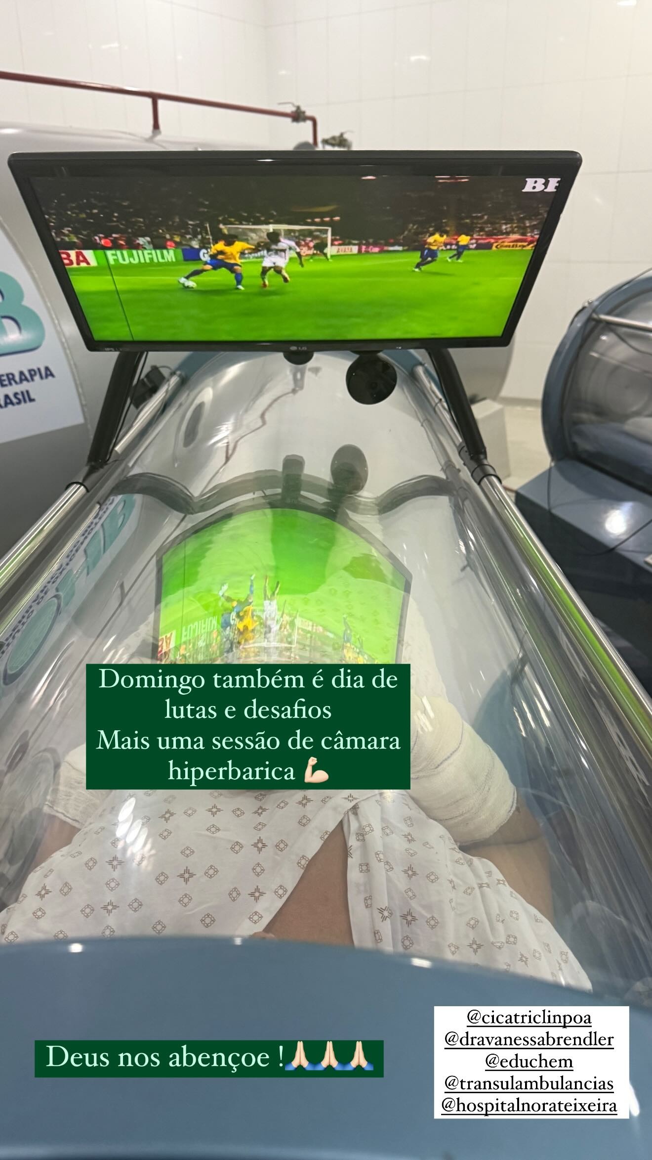 Câmara hiperbárica: entenda o tratamento de Lúcio após queimadura