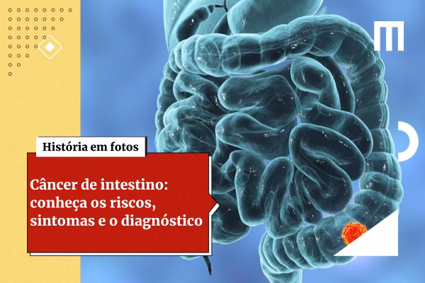 Preta Gil: por que casos de câncer de intestino crescem entre jovens