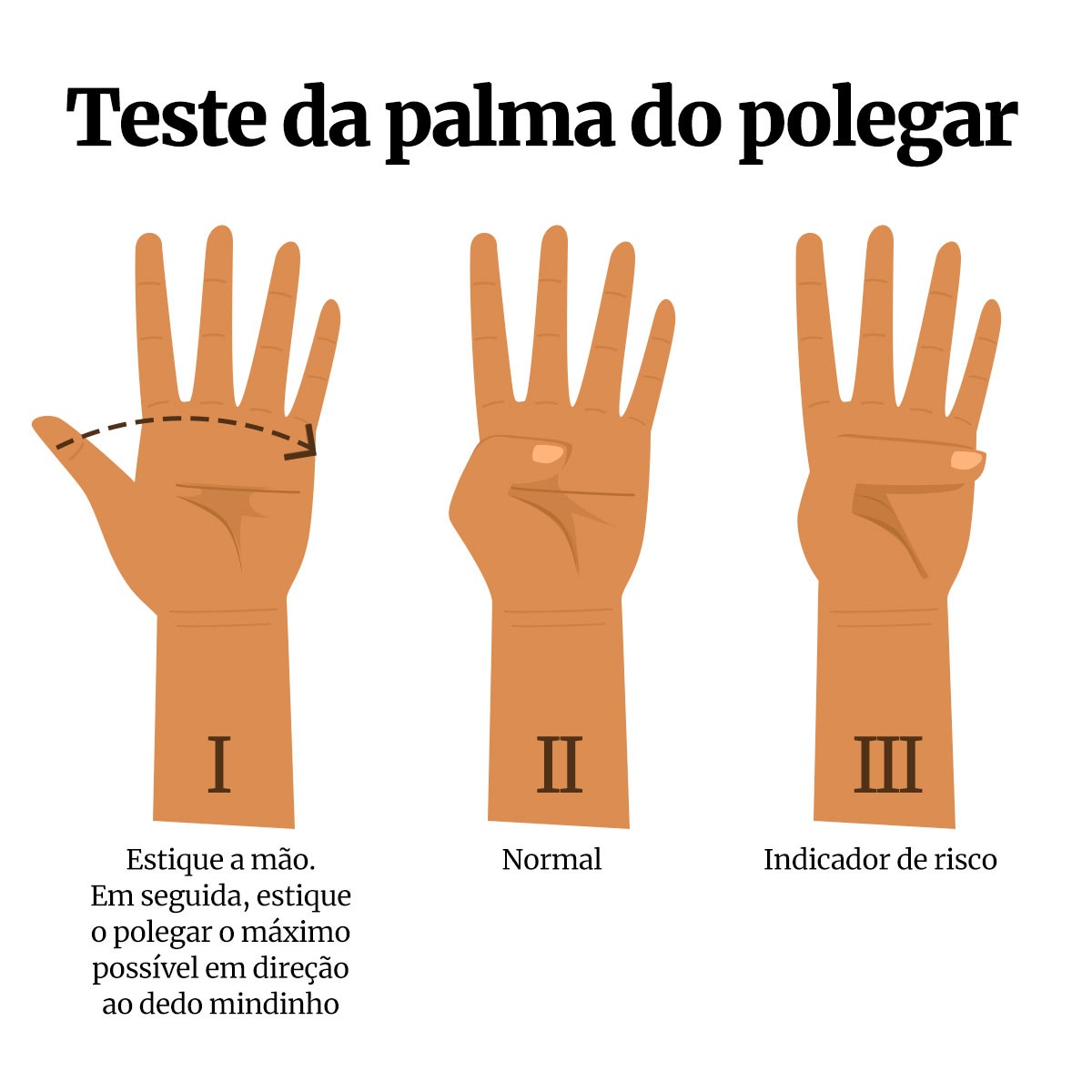 Vídeo: médico ensina truque com dedo que avalia risco de aneurisma