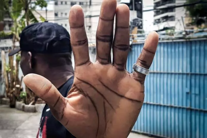 Rio terá capacitação de profissionais da saúde para atender vítimas de racismo